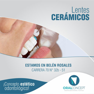 Lentes cerámicos